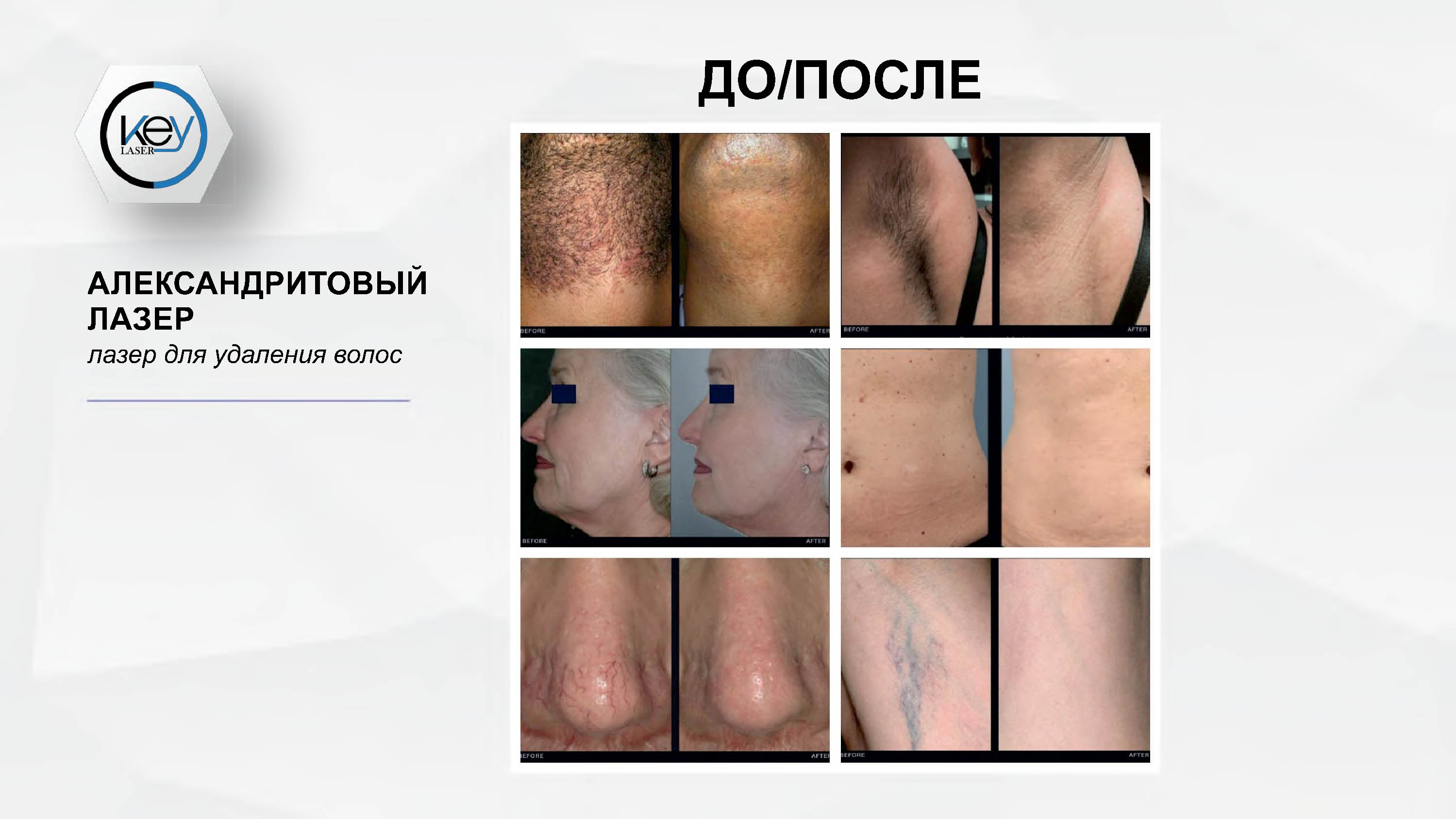 Принцип работы и результативность