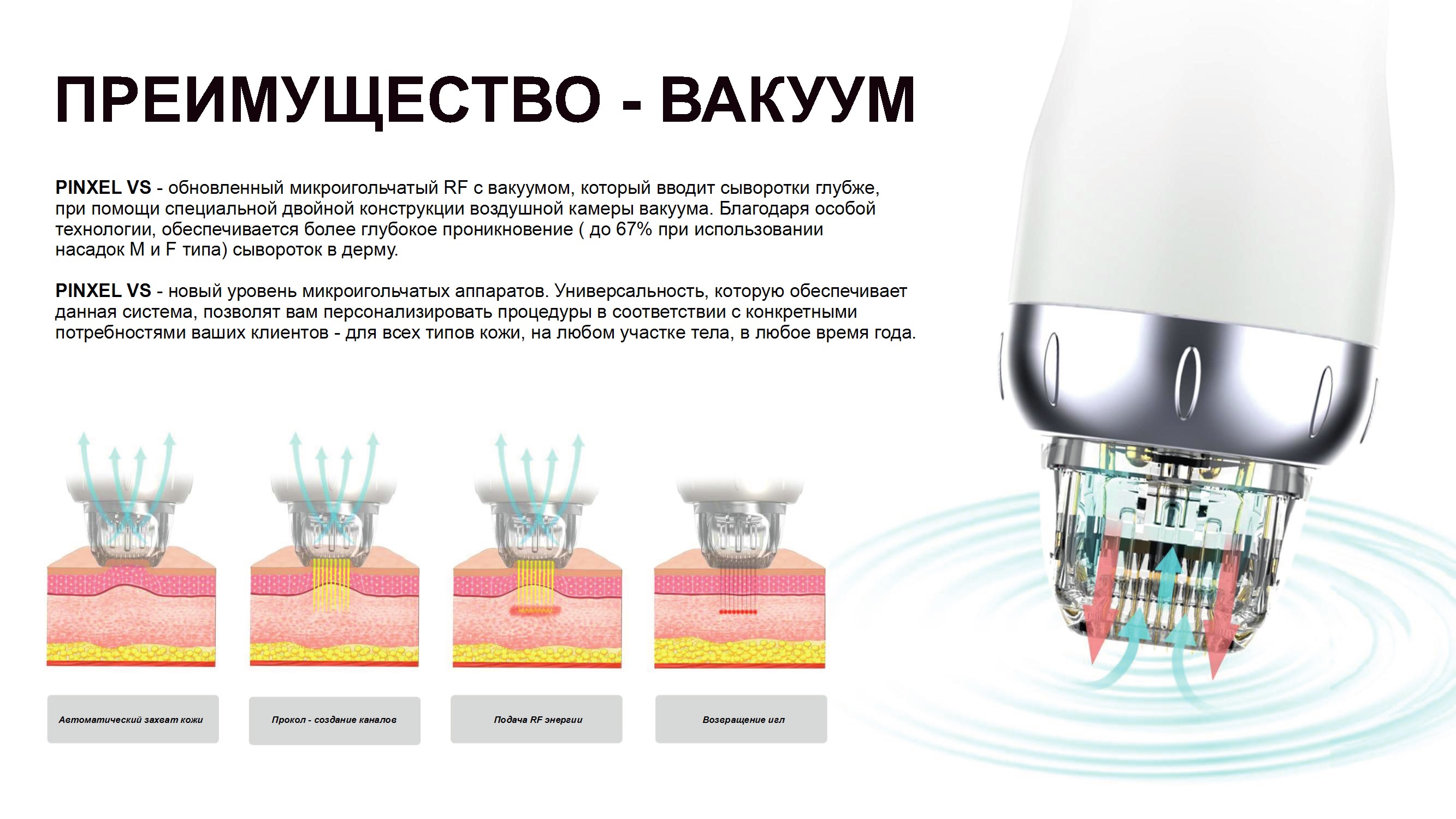 Преимущество вакуумной технологии Преимущество вакуумной технологии