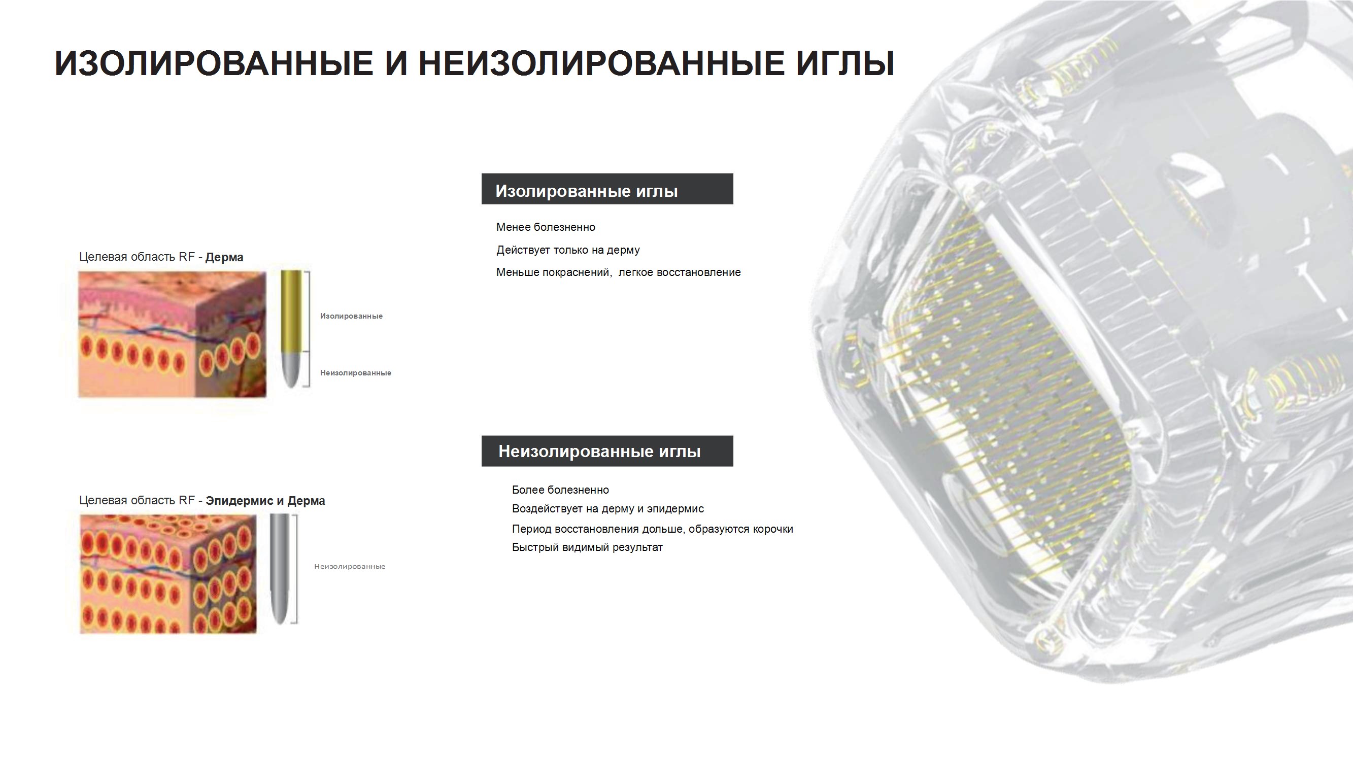 Технология изолированных и неизолированных игл Технология изолированных и неизолированных игл