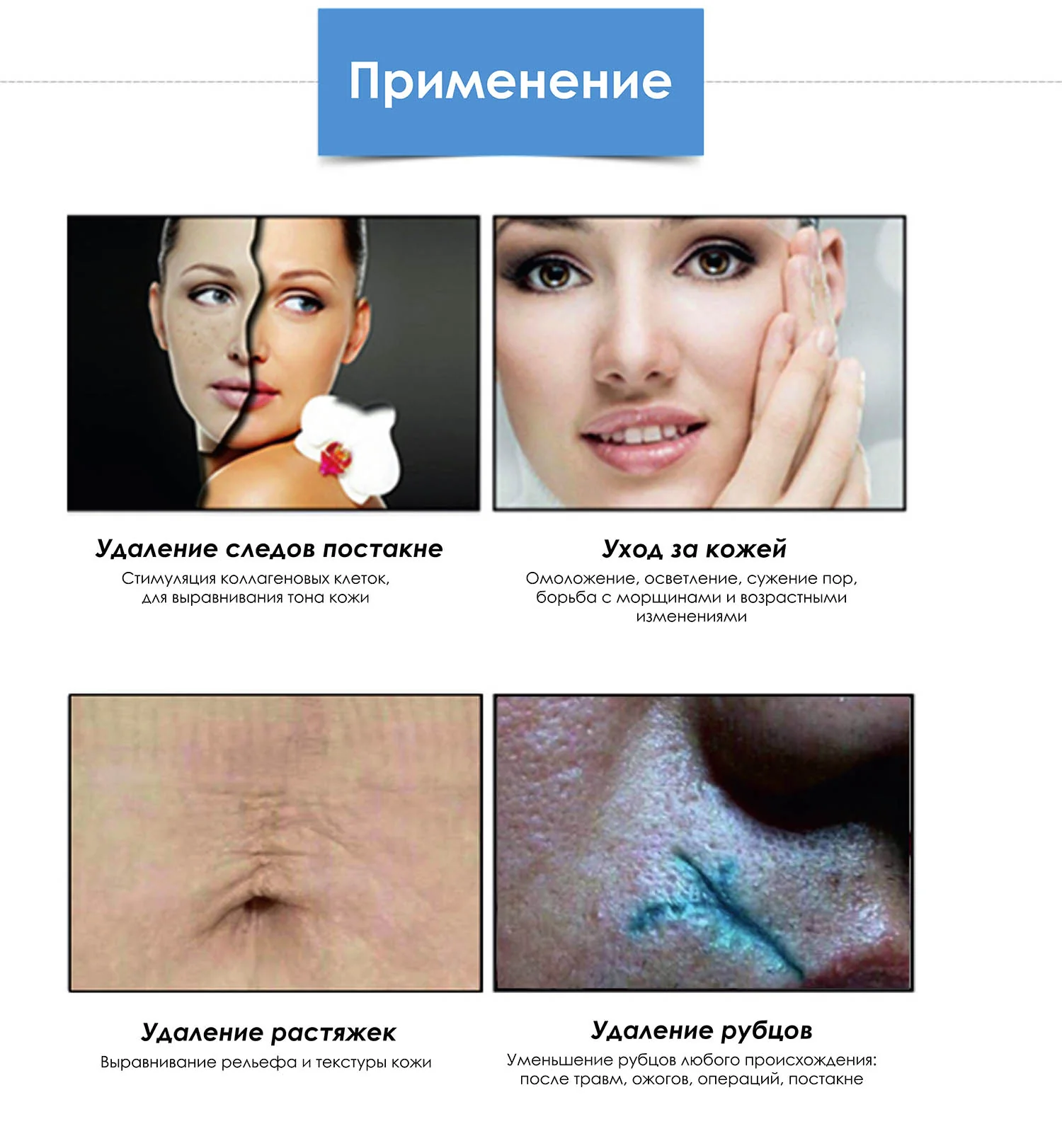 Области приминения Области приминения